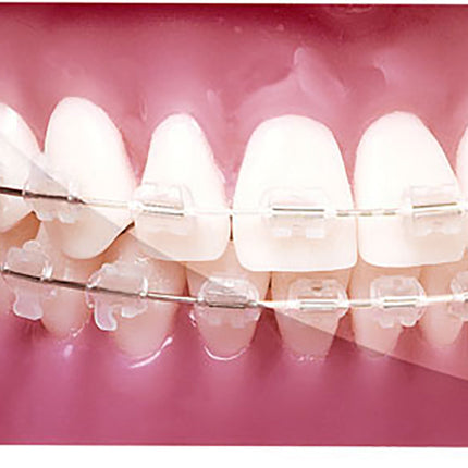 Reverse Curve G4 NiTi Tooth-Coloured  0.018 Upper 